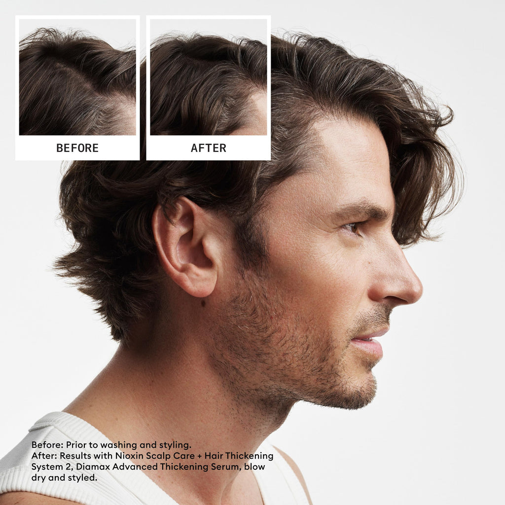 Nioxin Scalp + Hair Thickening Kits 3 Month Supply