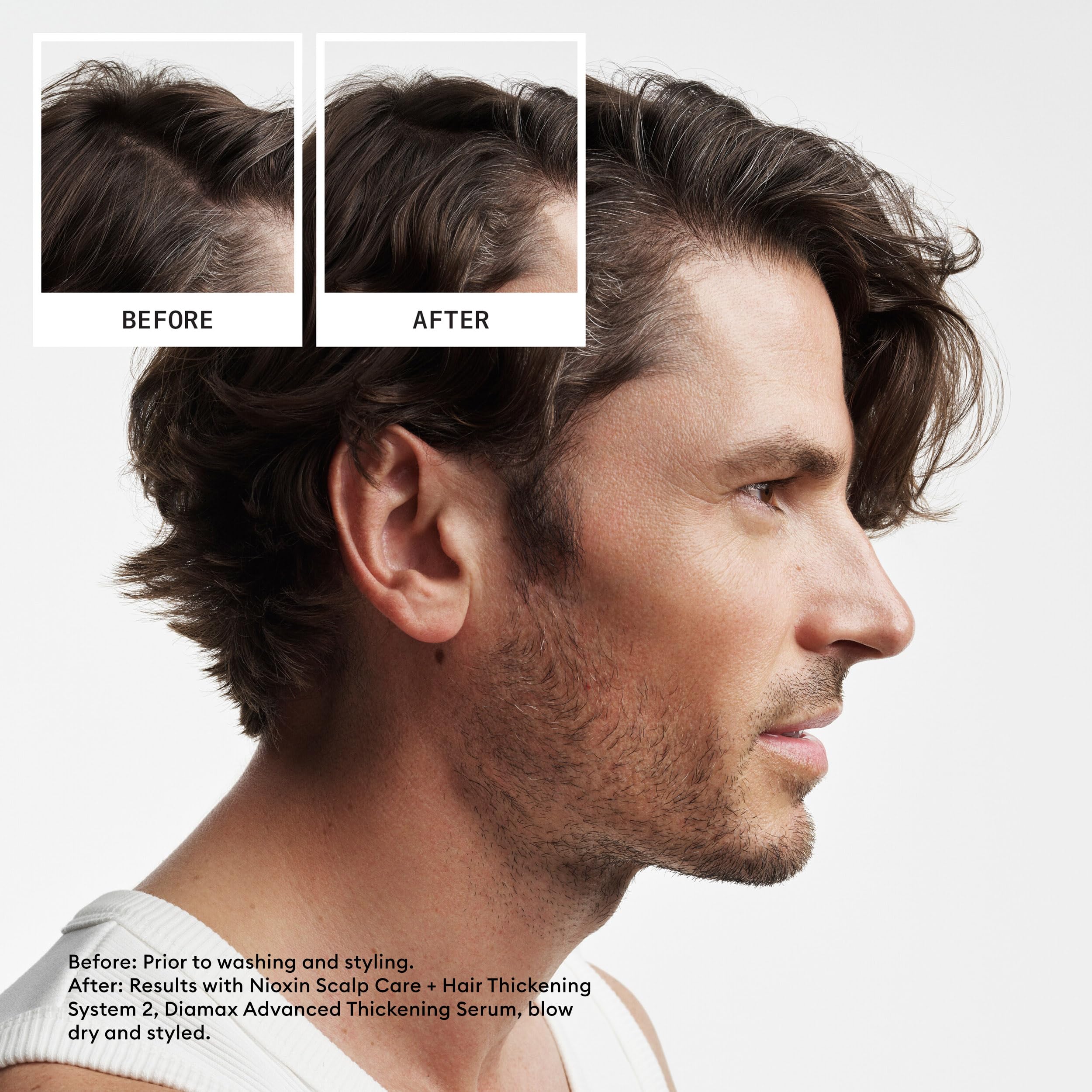 Nioxin Scalp + Hair Thickening Kits 3 Month Supply