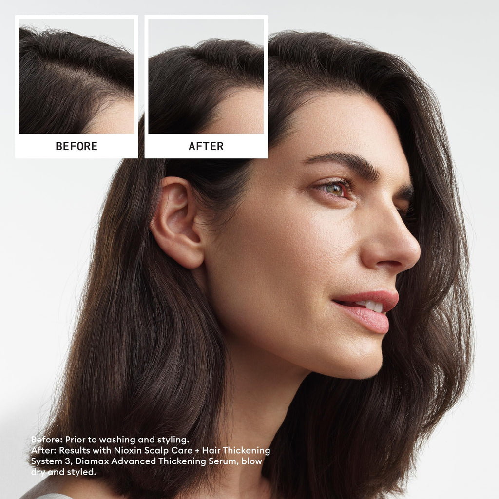Nioxin Scalp + Hair Thickening Kits 3 Month Supply